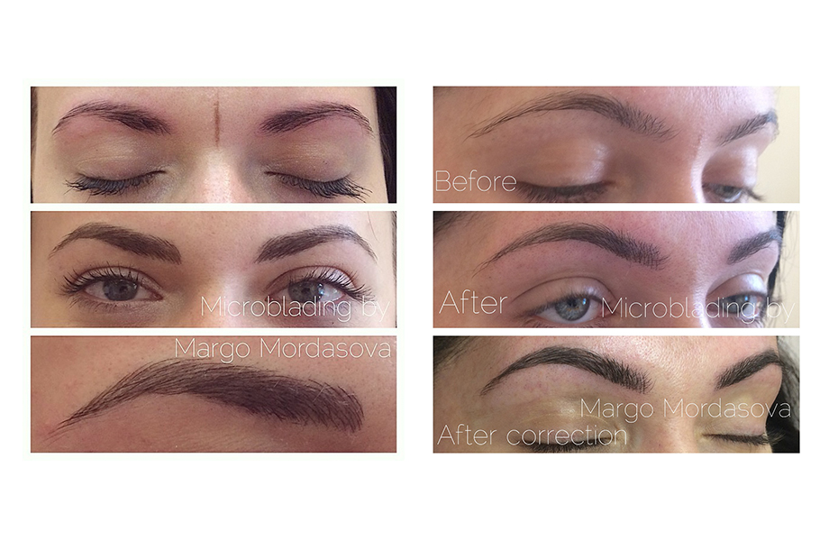 До и после применения техники микроблейдинга