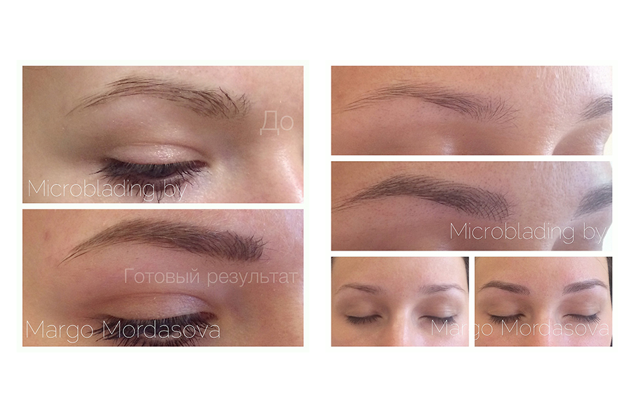 До и после применения техники микроблейдинга