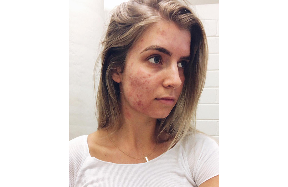 Бэк Джексон 