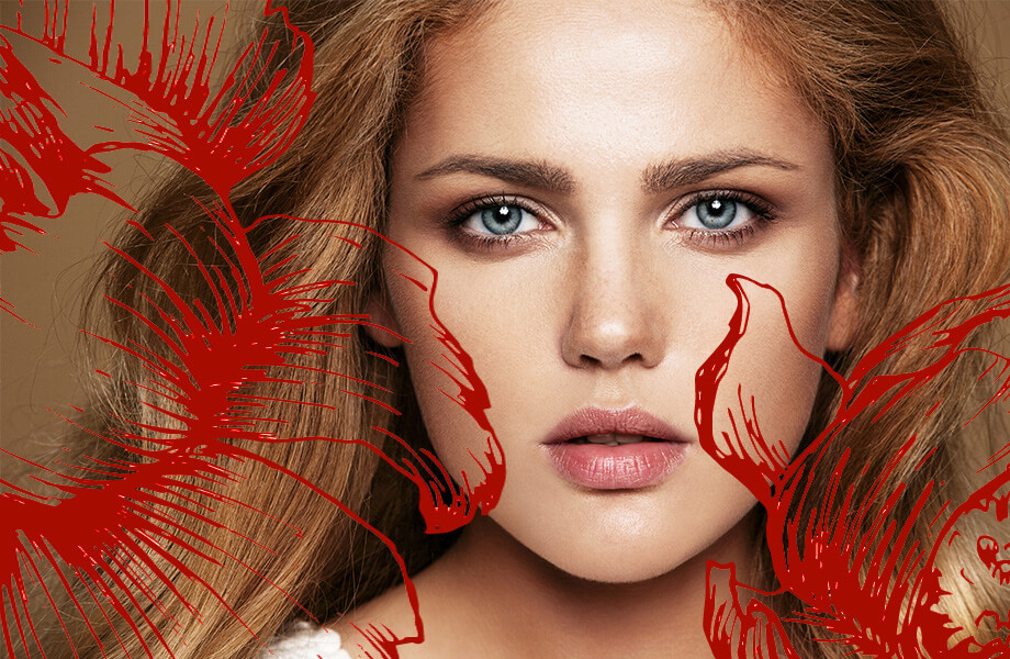 Атопический дерматит