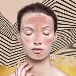 Пилинг Джесснера