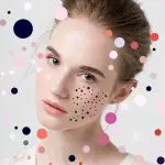 Виды прыщей