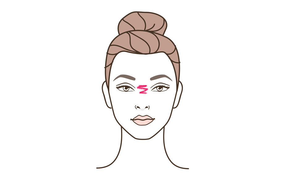 кроличьи морщины