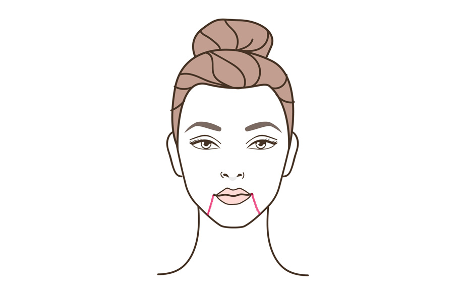 морщины марионетки