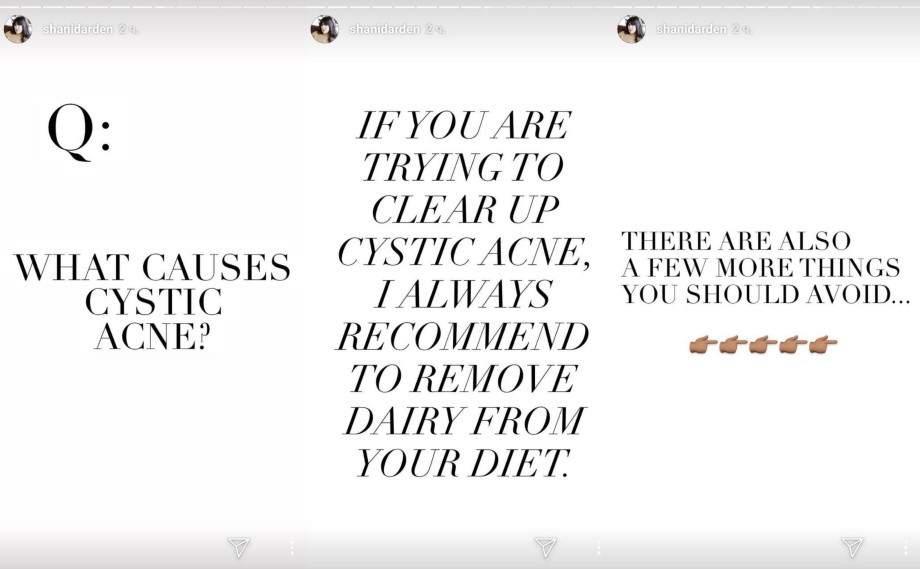 Шани Дарден