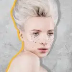 5 причин «усталого» взгляда