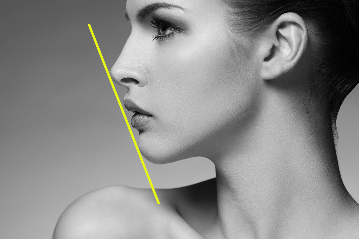 линия Рикетса