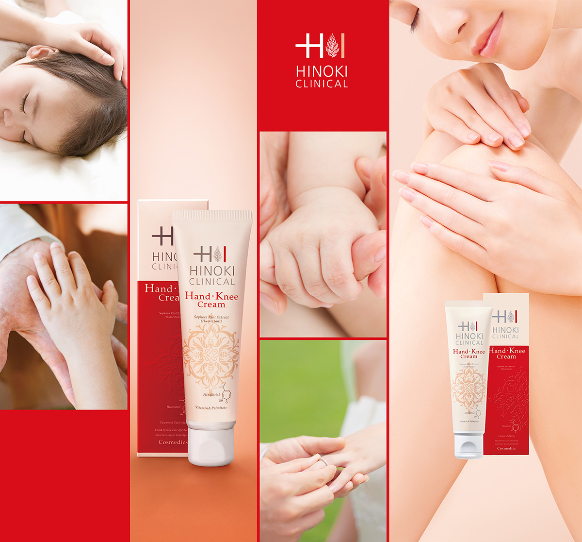 Экзема рук: побочный эффект антисептики от коронавируса