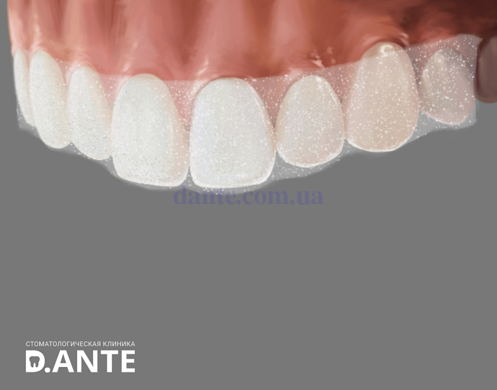 Отбеливание зубов в домашних условиях: интервью с экспертом