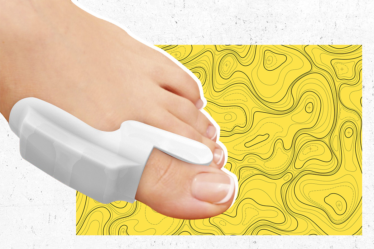 Как убрать косточки на ногах в домашних условиях