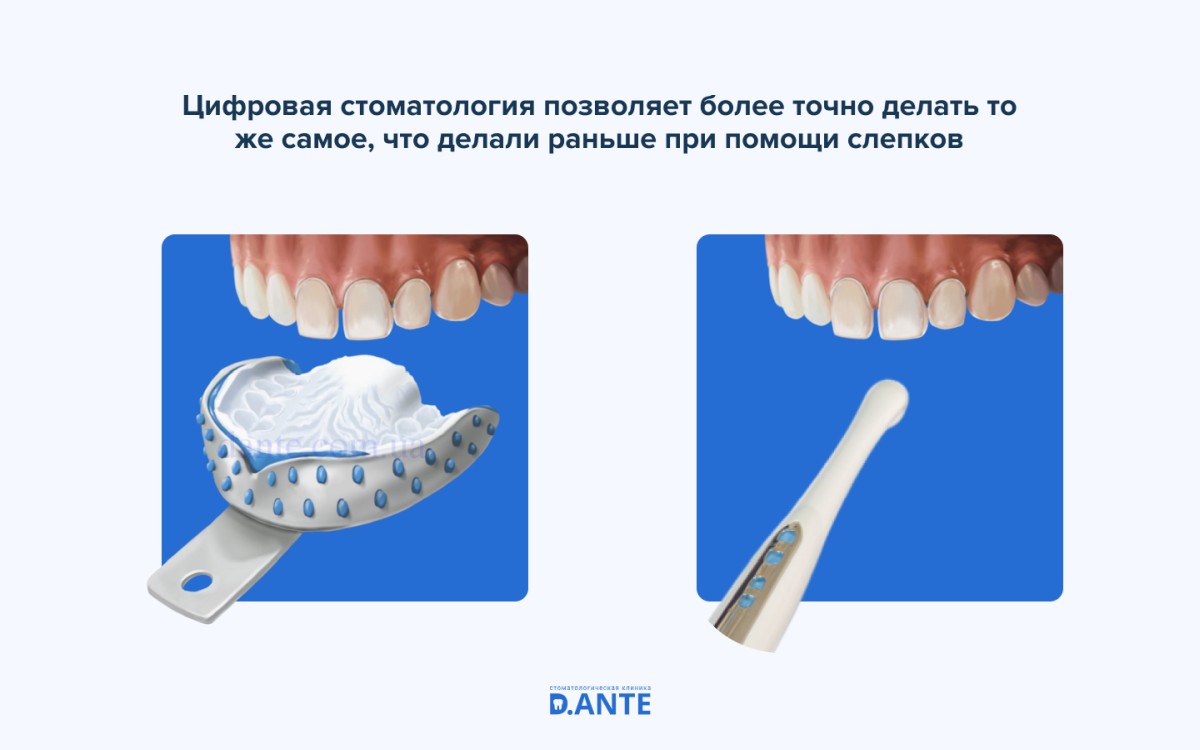 Цифровая стоматология: что это такое и кому это нужно