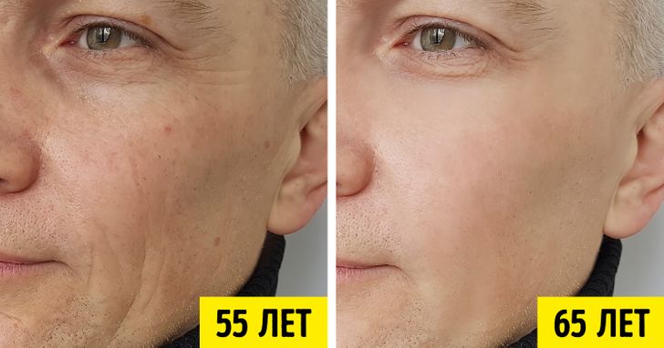 Ученый раскрыл секрет молодости 