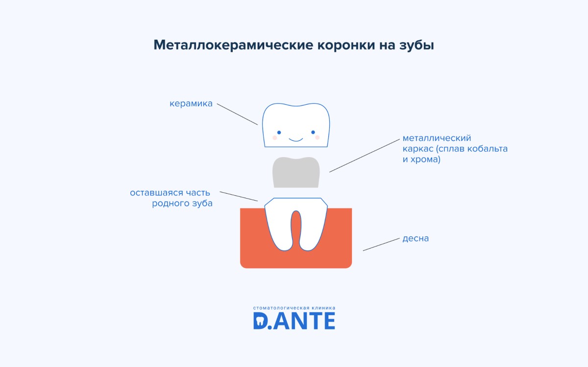 Коронки на зуби: показання, види, вартість
