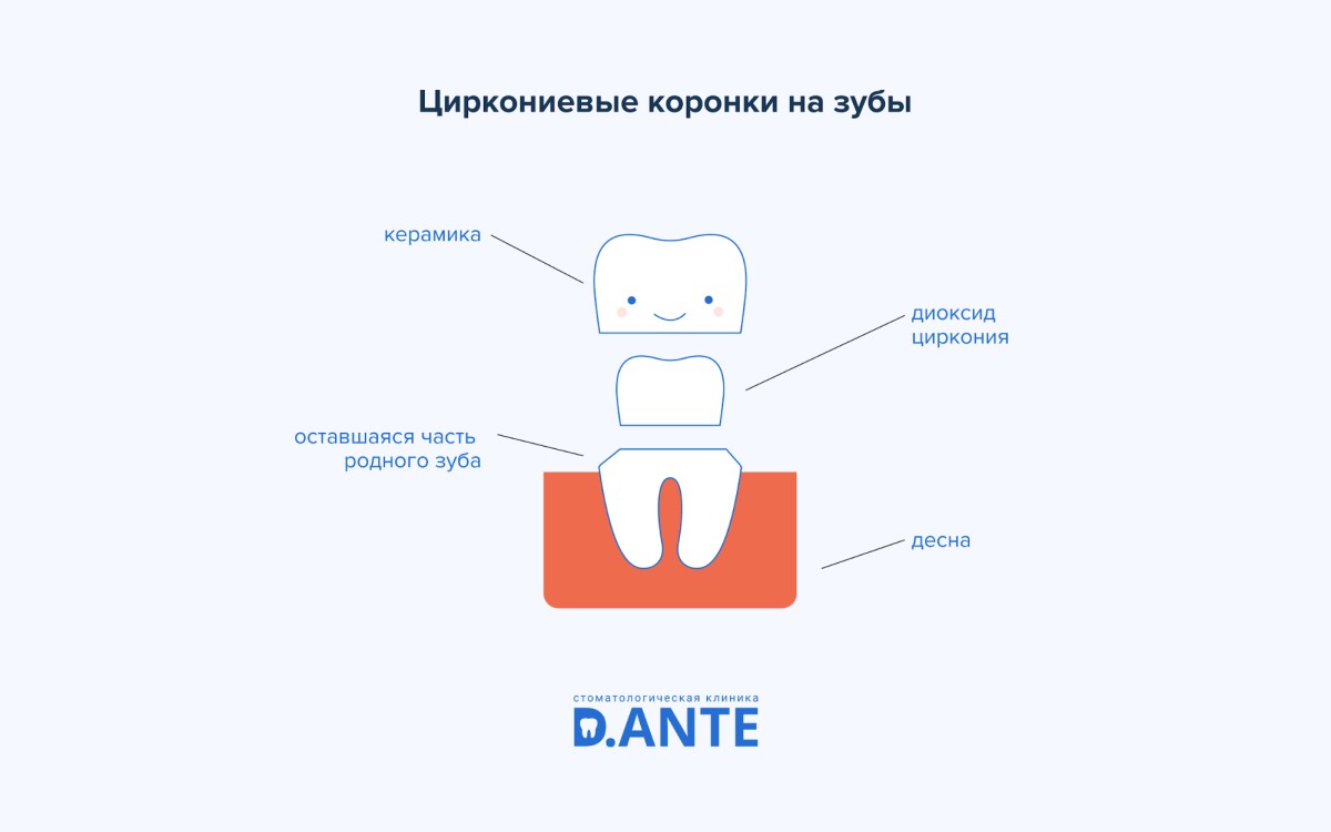 Коронки на зуби: показання, види, вартість