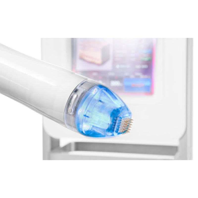 Wow Fresh Vivace: что это за процедура для лица и кому нужна