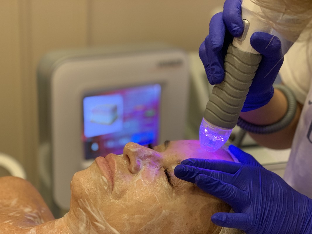 Wow Fresh Vivace: что это за процедура для лица и кому нужна