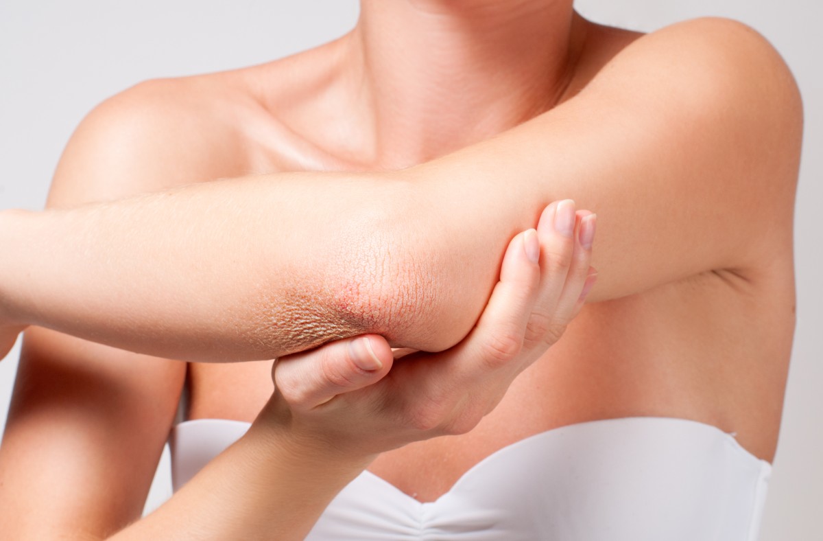 Грибковое заболевание кожи