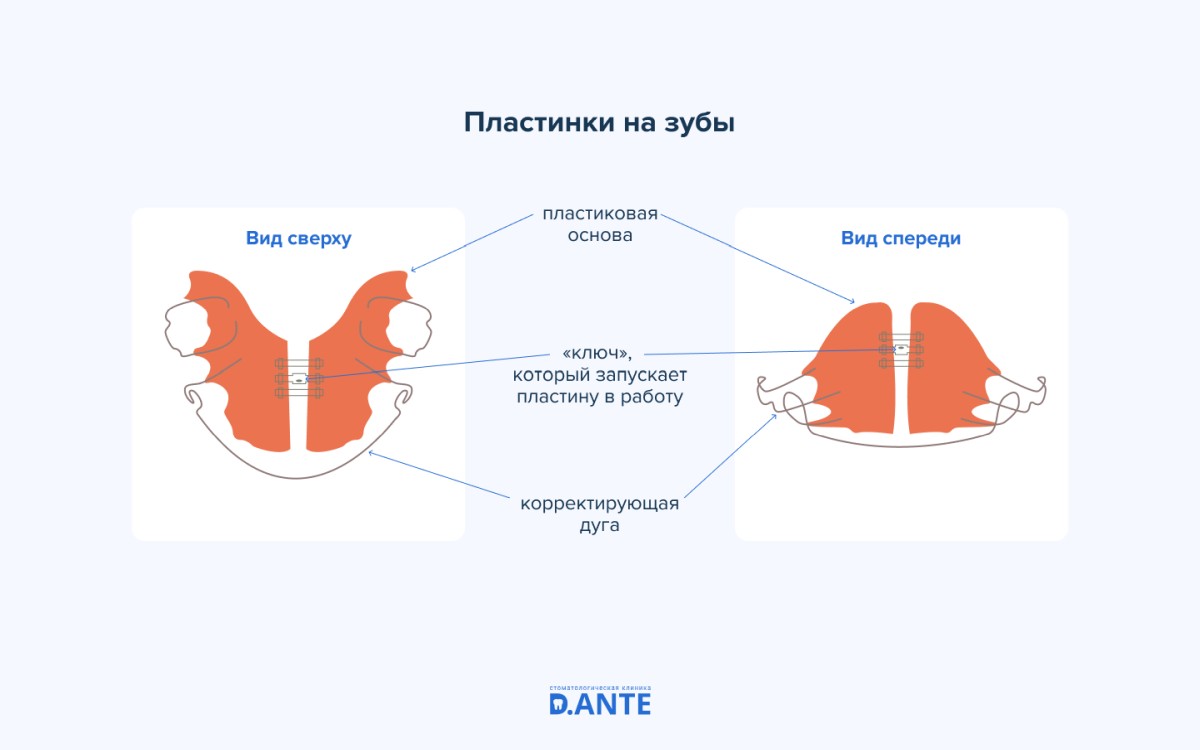 Пластинки на зубы