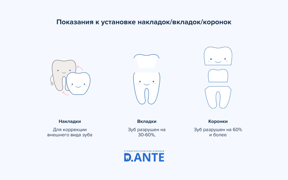 Накладки на зубы или вкладки в зубы?