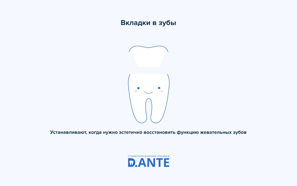 Накладки на зубы или вкладки в зубы?