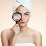 Экспресс-метод: как быстро избавиться от прыща