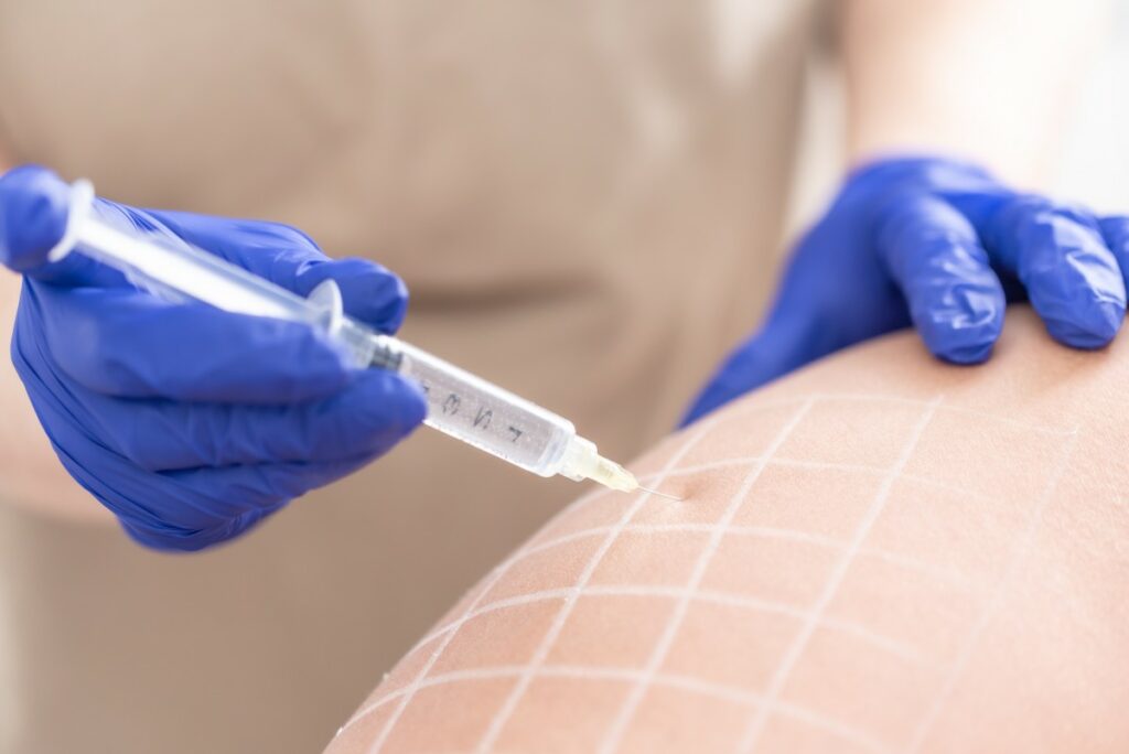 Що таке ліполітики і що потрібно знати перед процедурою