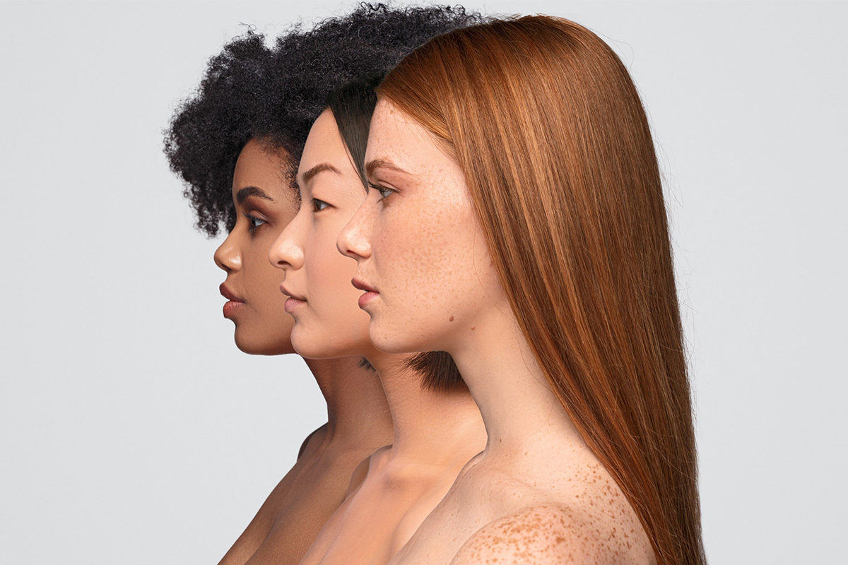 что такое пигментация