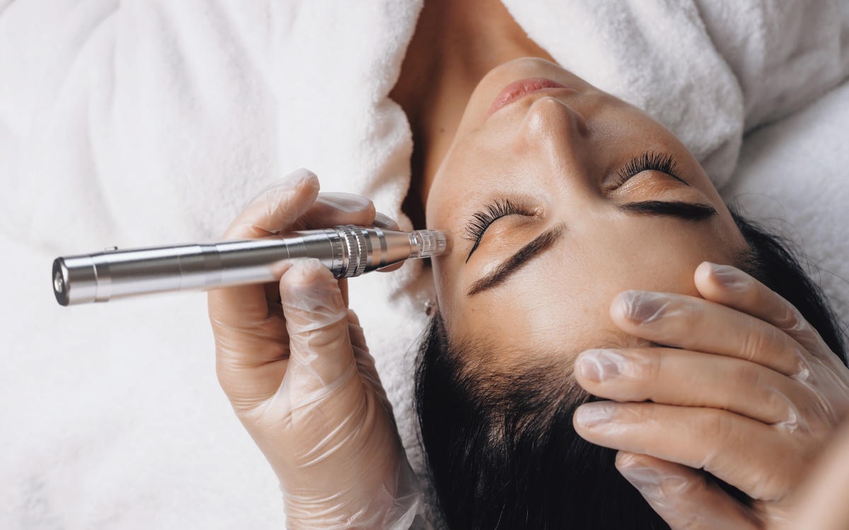 как избавиться от следов акне