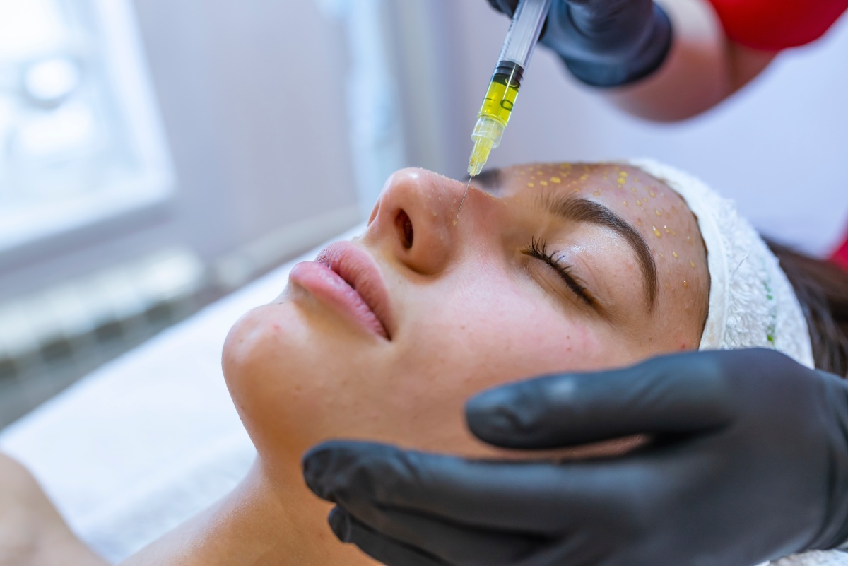 мезотерапия при пигментации