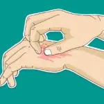 контактный дерматит