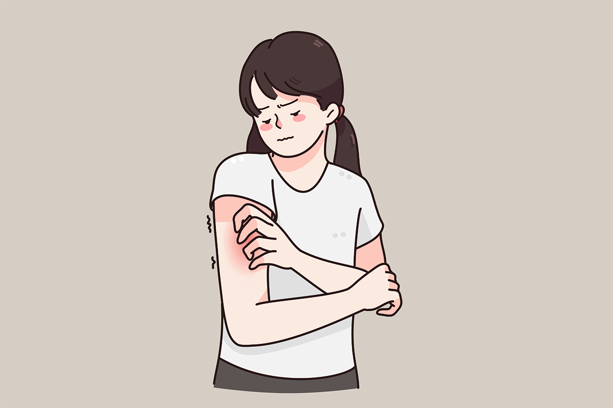 аллергический контактный дерматит