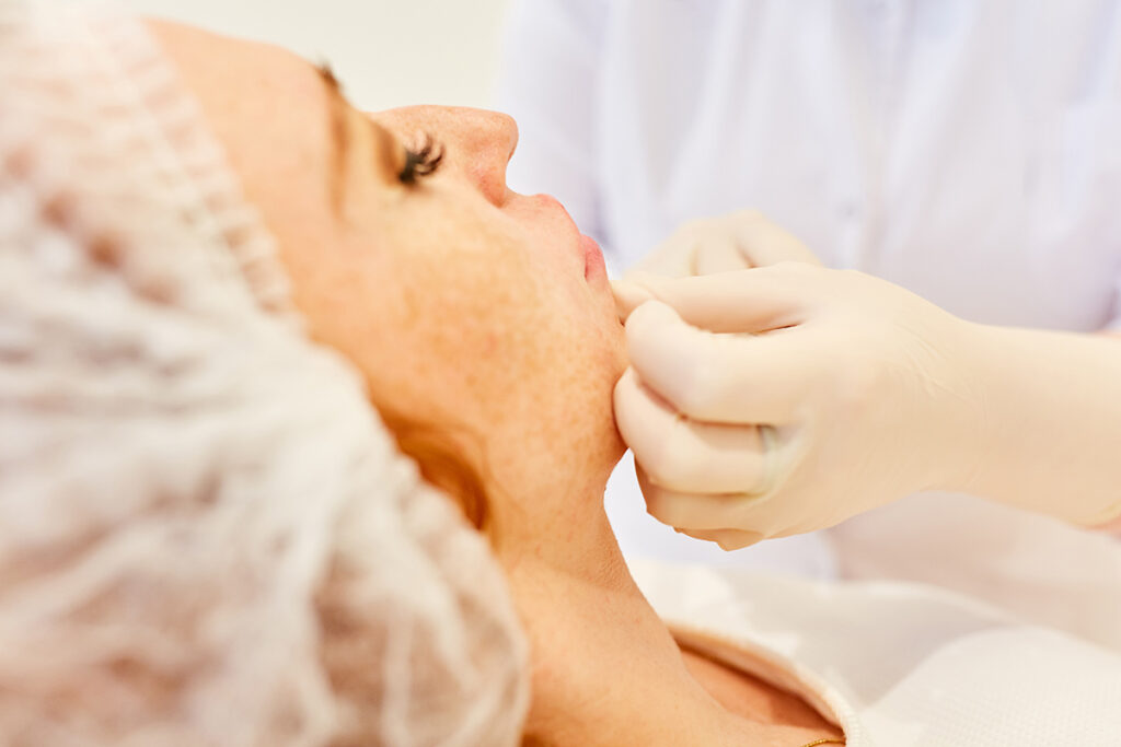 Заеды в уголках рта: почему появляются и как лечить