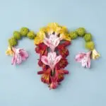 Синдром полікістозних яєчників