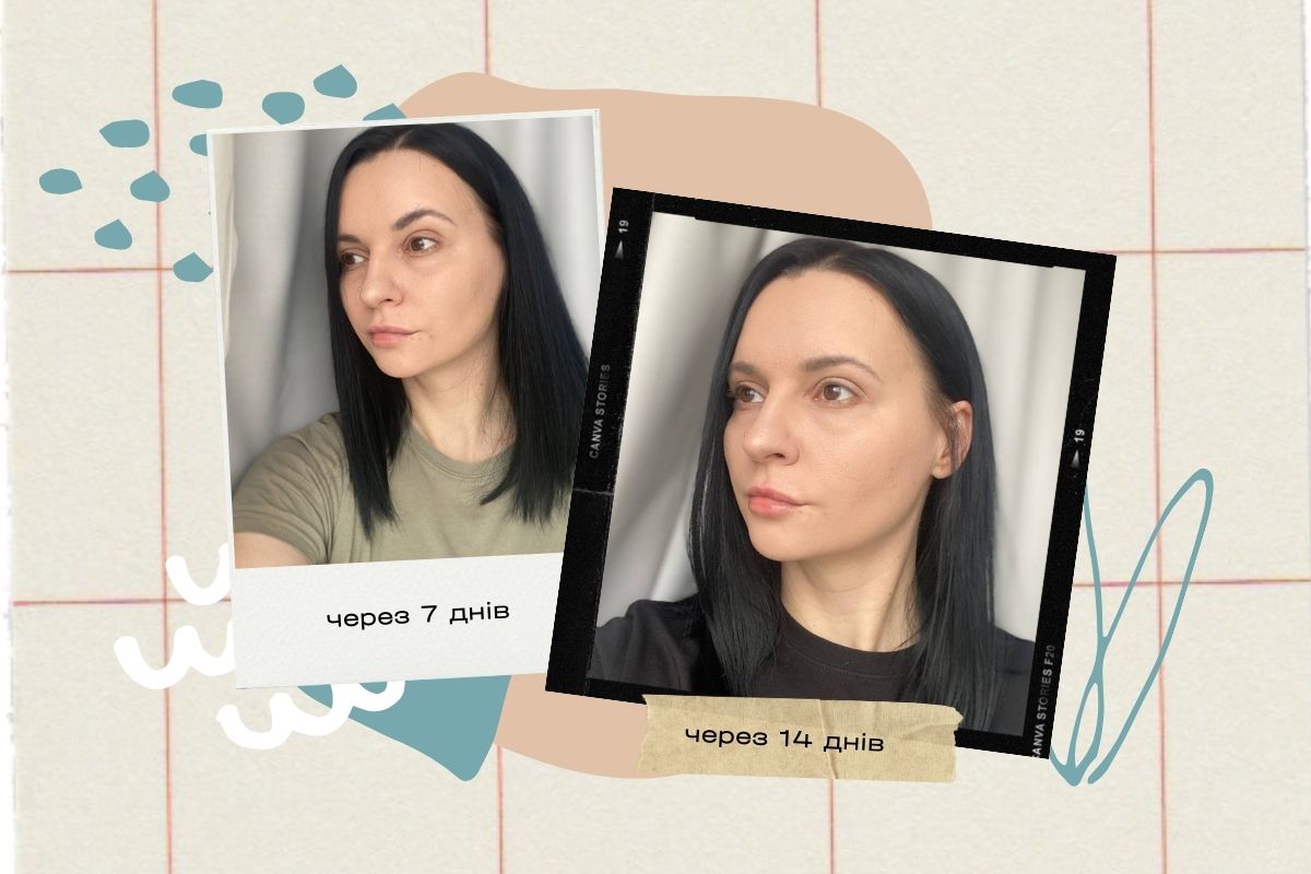 результати редермалізації